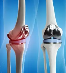 Orthopedic treatment at S&S Clinic Hyderabad