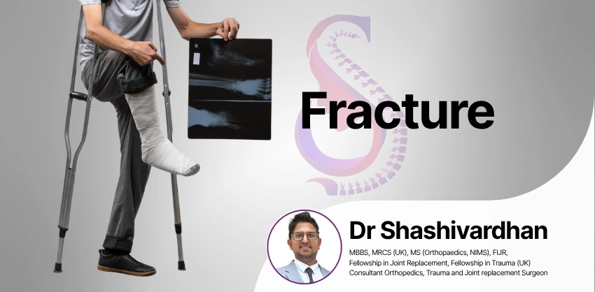 Fracture Treatment in Hyderabad - S&S Clinics