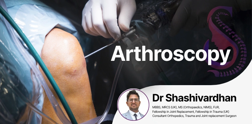 Arthroscopy at S&S Clinics, Manikonda, Hyderabad
