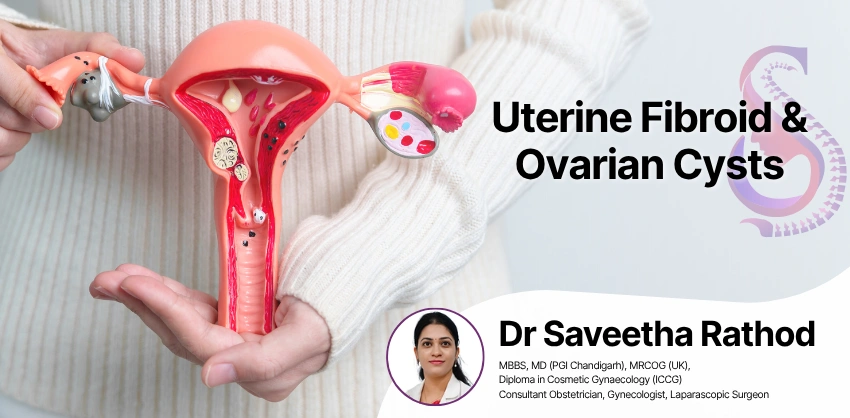Fibroids & Ovarian Cysts at S&S Clinics, Manikonda, Hyderabad